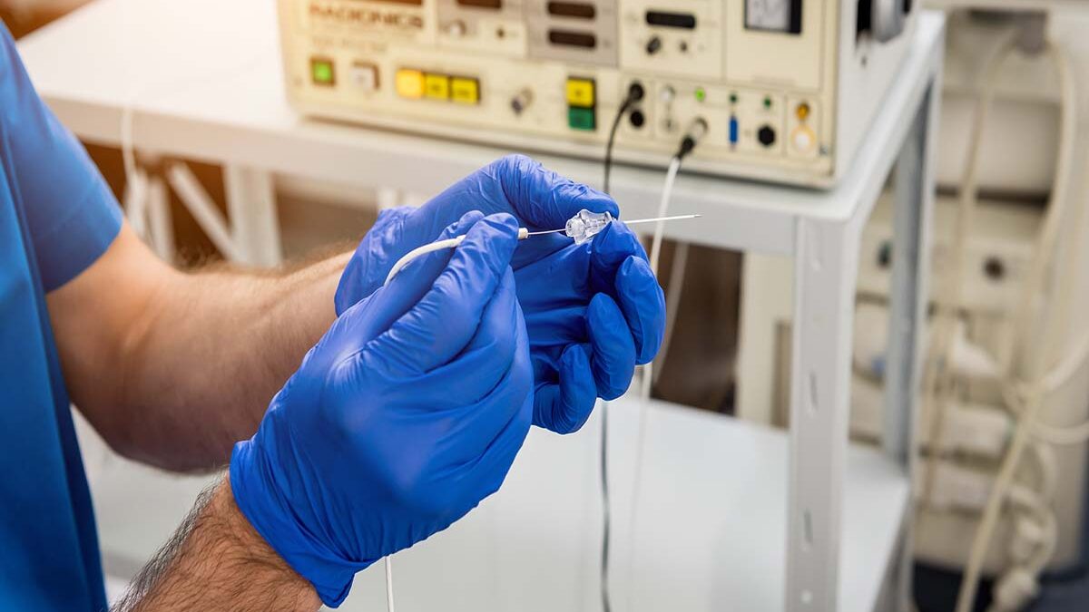 What is Radio Frequency Ablation? What is Radio Frequency Ablation?