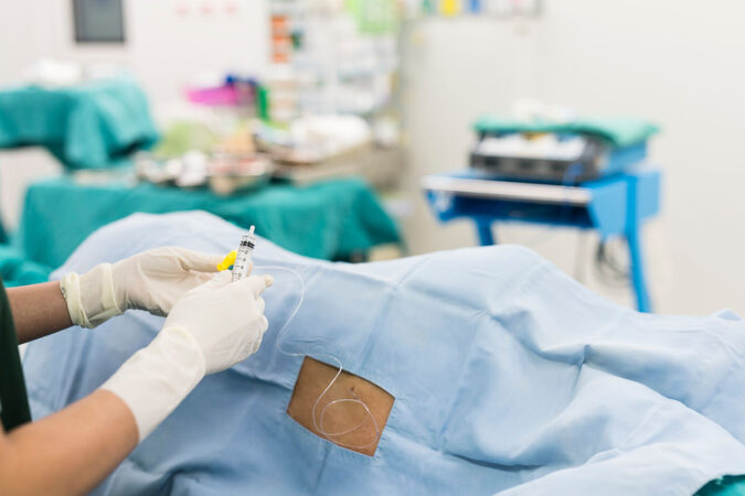 The Epidural Steroid Injection Process