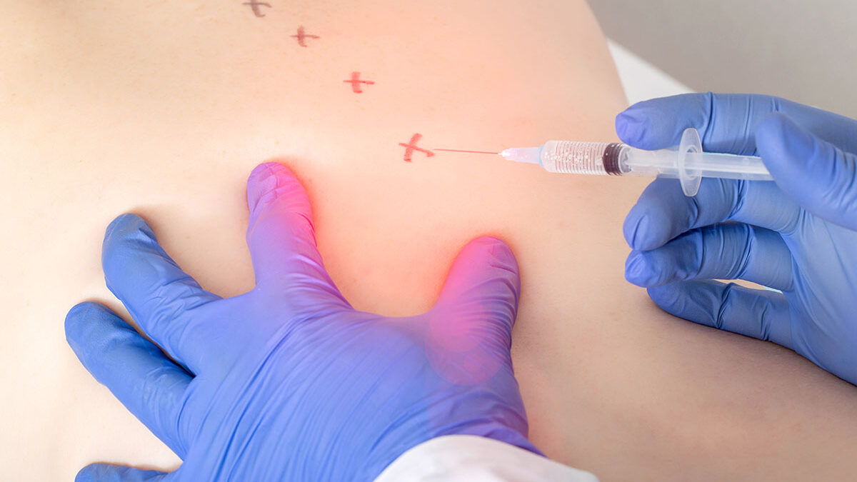 Can an Epidural Steroid Injection Work for Your Inflammation? Can an Epidural Steroid Injection Work for Your Inflammation?