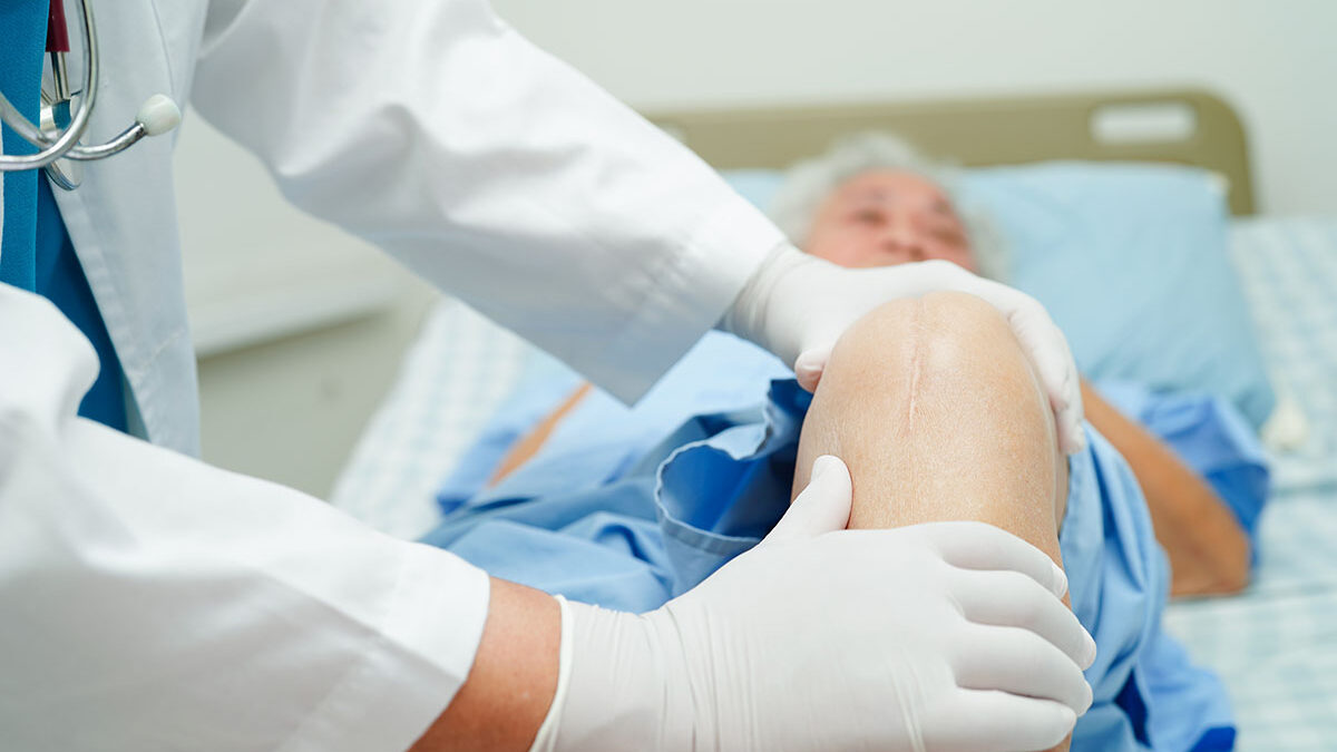 Are You Too Old for Knee Replacement Surgery? Are You Too Old for Knee Replacement Surgery?
