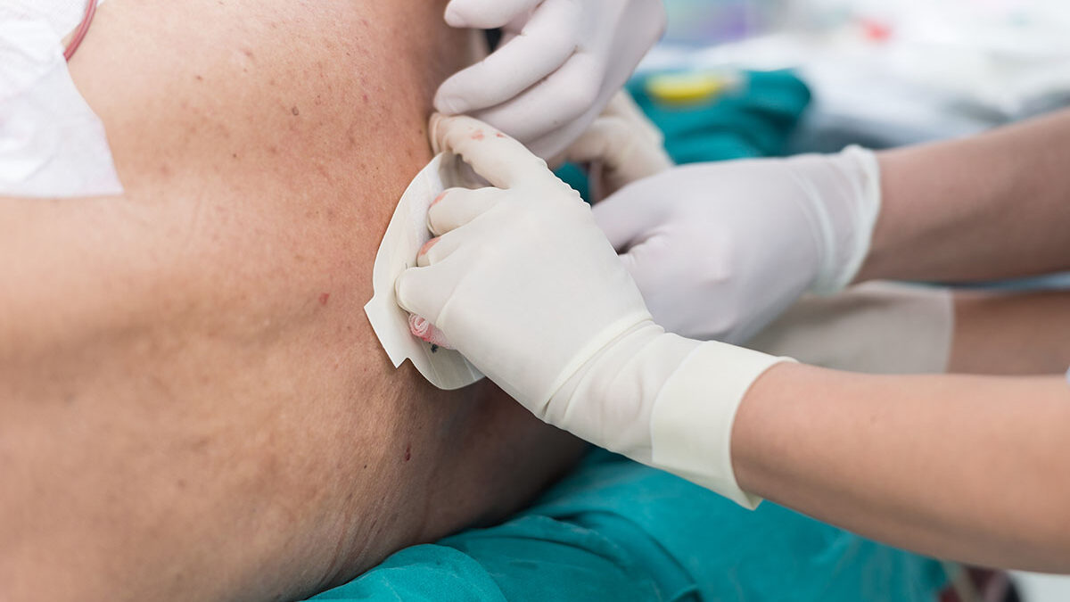 Side Effects Of Epidural Steroid Injections Side Effects Of Epidural Steroid Injections