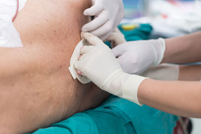 Side Effects Of Epidural Steroid Injections Side Effects Of Epidural Steroid Injections