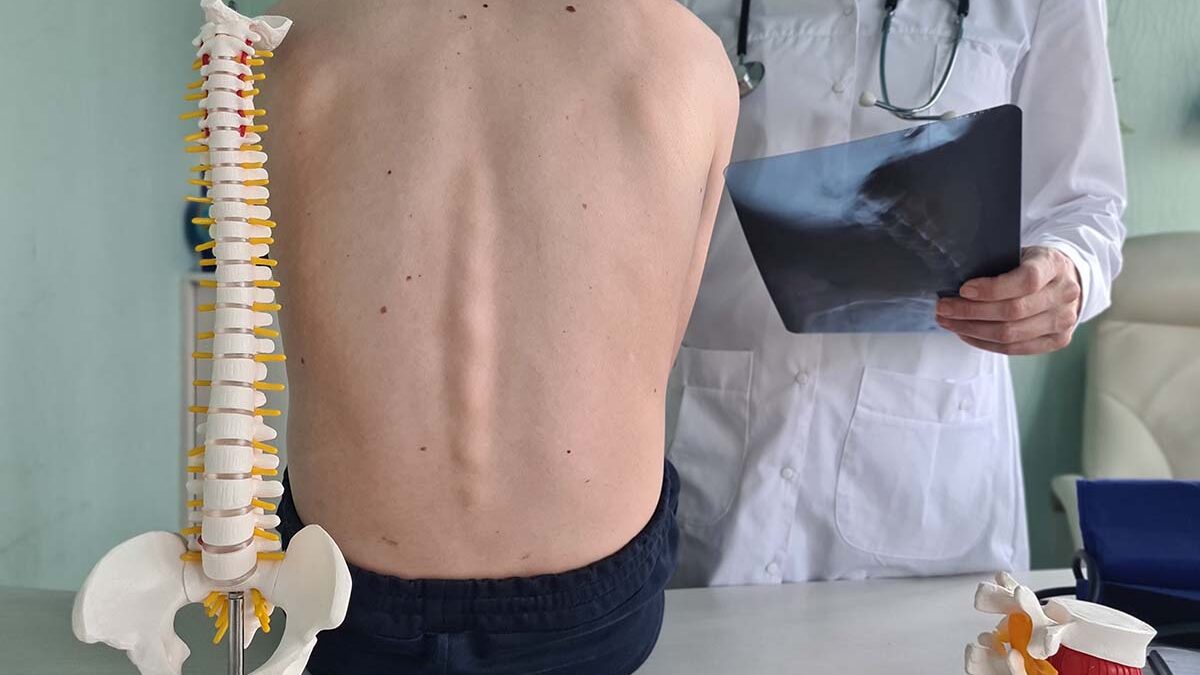 What Questions Should I Ask My Neurosurgeon Before A Spine Surgery? What Questions Should I Ask My Neurosurgeon Before A Spine Surgery?