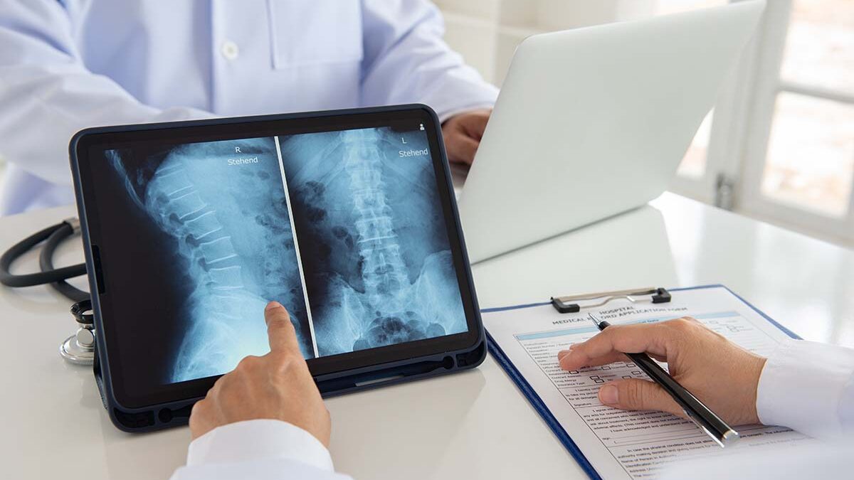 How to treat a Herniated Disc How to treat a Herniated Disc