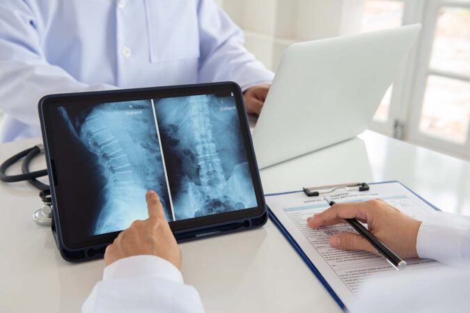 How to treat a Herniated Disc How to treat a Herniated Disc