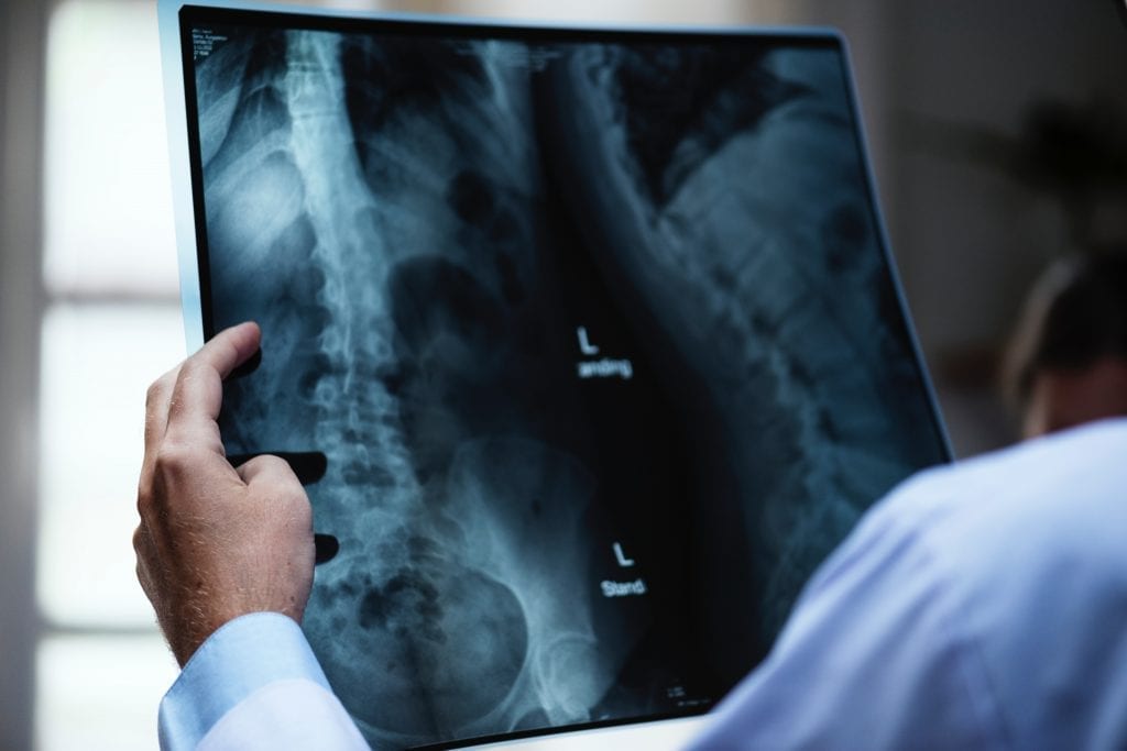 Spine problems