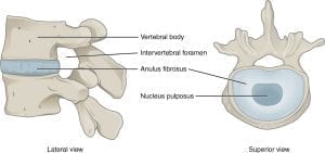 aritifical disc replacement