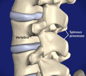 Spinous Process Pain