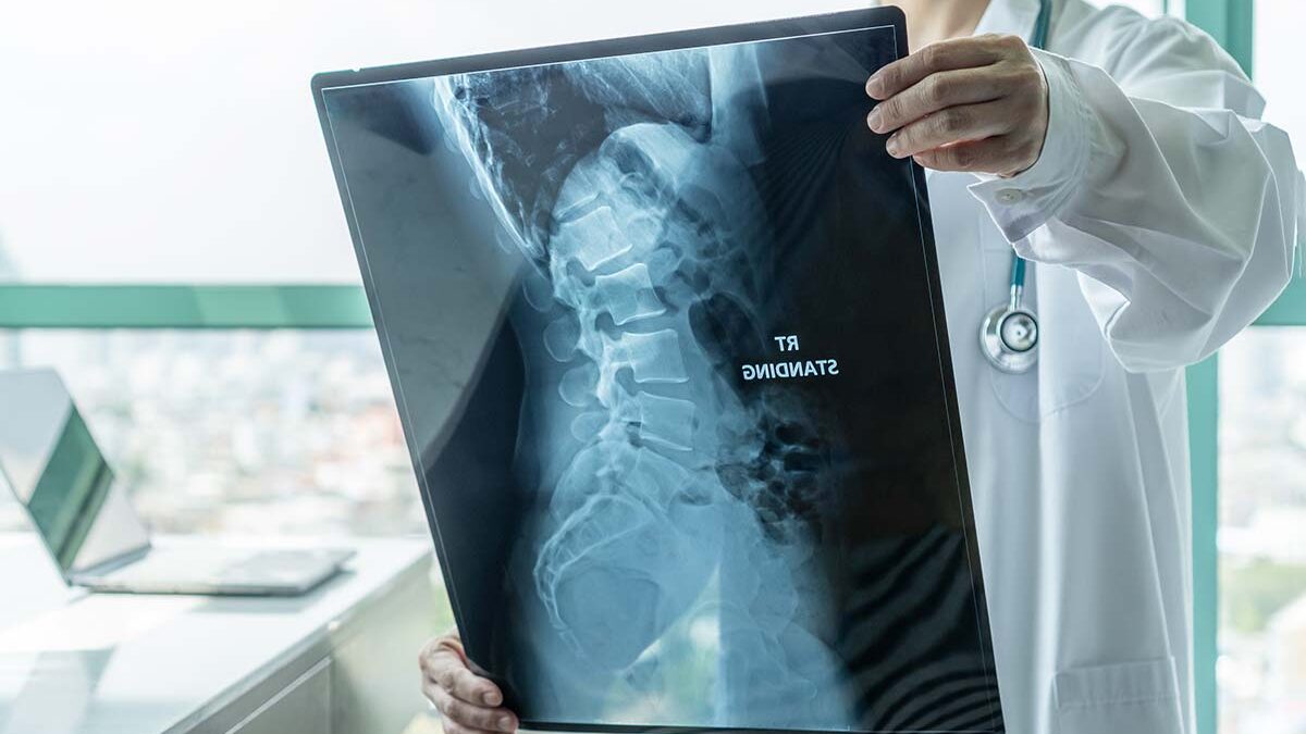 Is Surgery Required For Collapsed Discs? Is Surgery Required For Collapsed Discs?