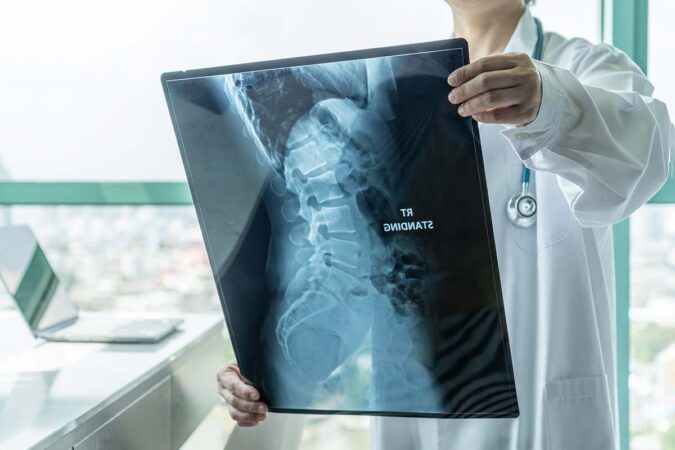 Is Surgery Required For Collapsed Discs? Is Surgery Required For Collapsed Discs?