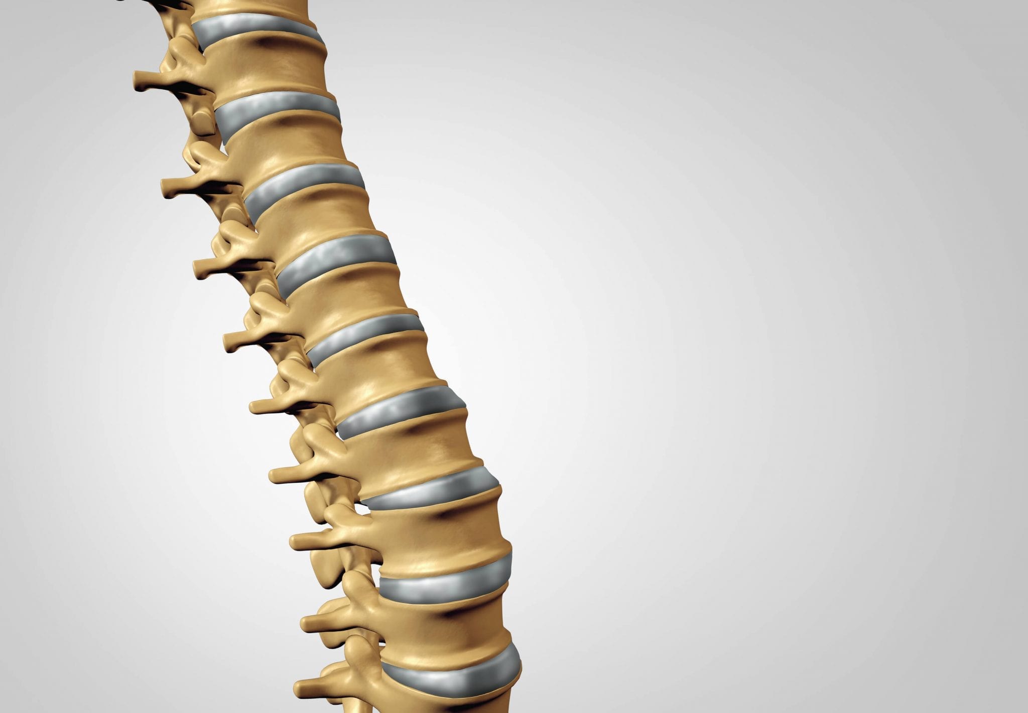 Prolapsed Disc