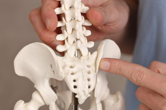 Who is a Candidate for a Coflex Implant? Who is a Candidate for a Coflex Implant?