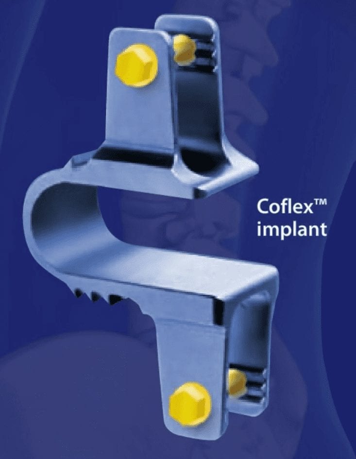 Co Flex Implant