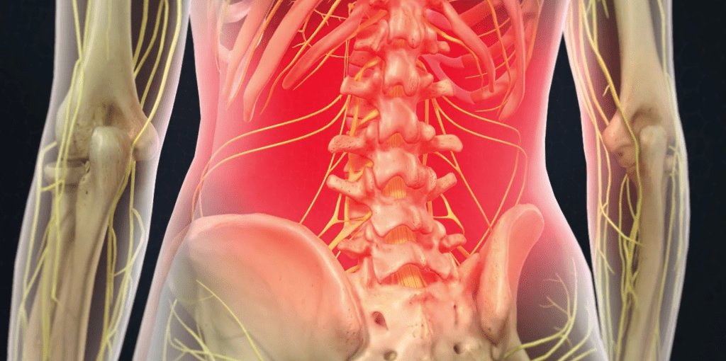 Back Pain