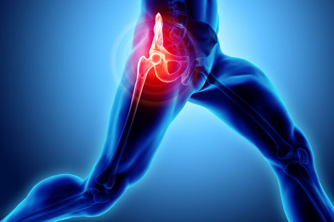 What You Should Know About Hip Pain What You Should Know About Hip Pain