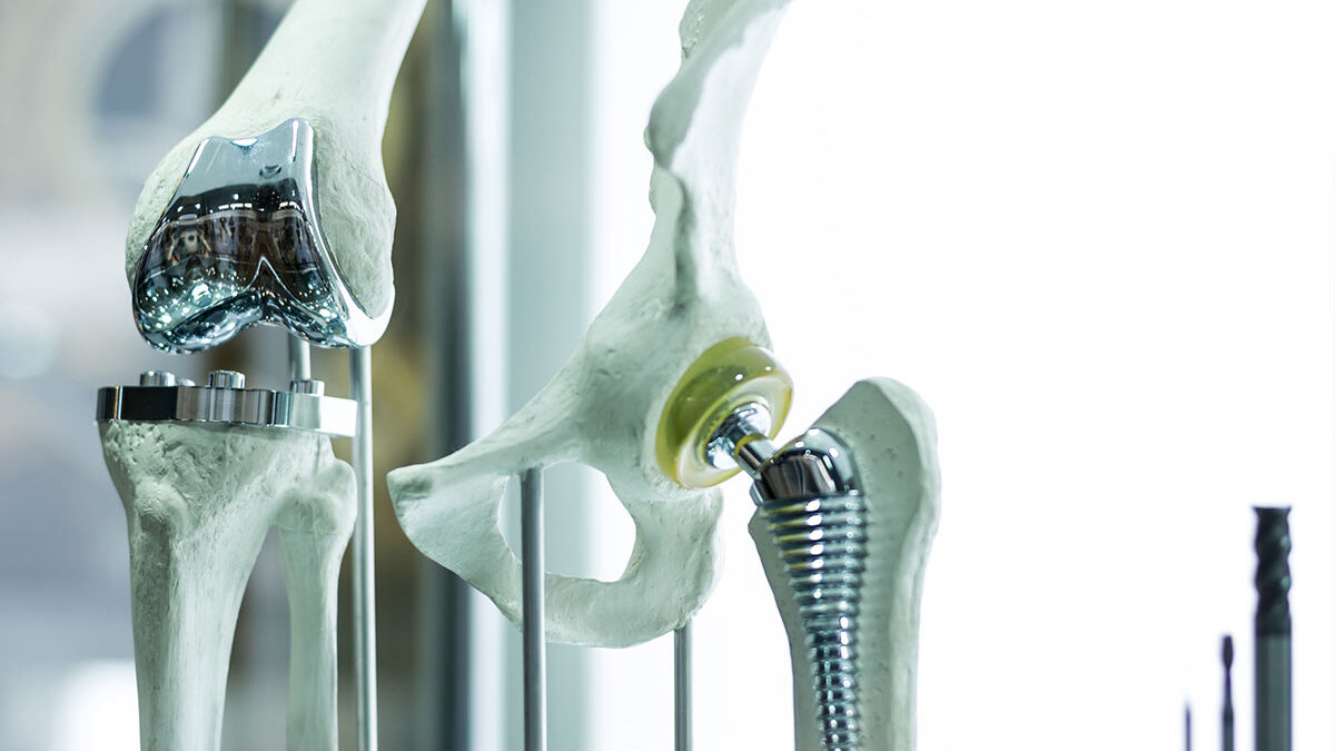 Orthopedic Interventions: Florida Specialists Offer Advanced Care Orthopedic Interventions: Florida Specialists Offer Advanced Care
