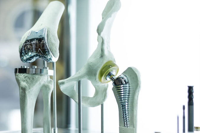 Orthopedic Interventions: Florida Specialists Offer Advanced Care Orthopedic Interventions: Florida Specialists Offer Advanced Care
