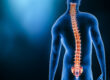 Why you should see a Neurosurgeon for your spine pain