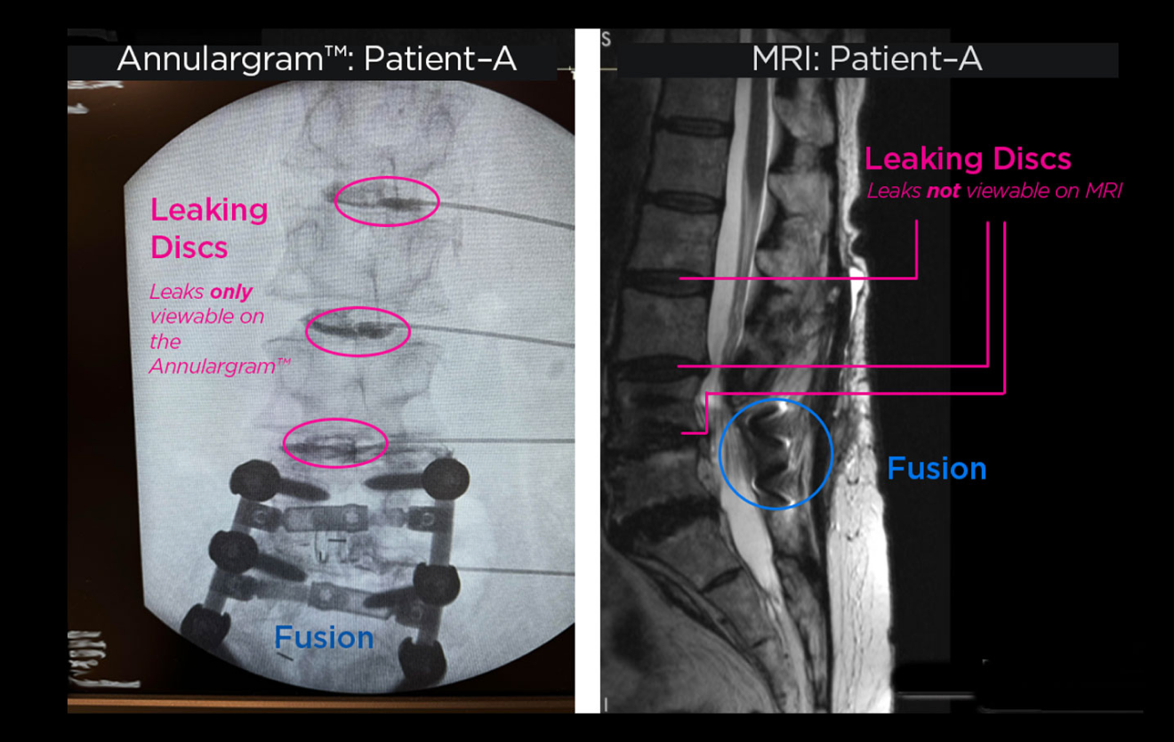 mri-img