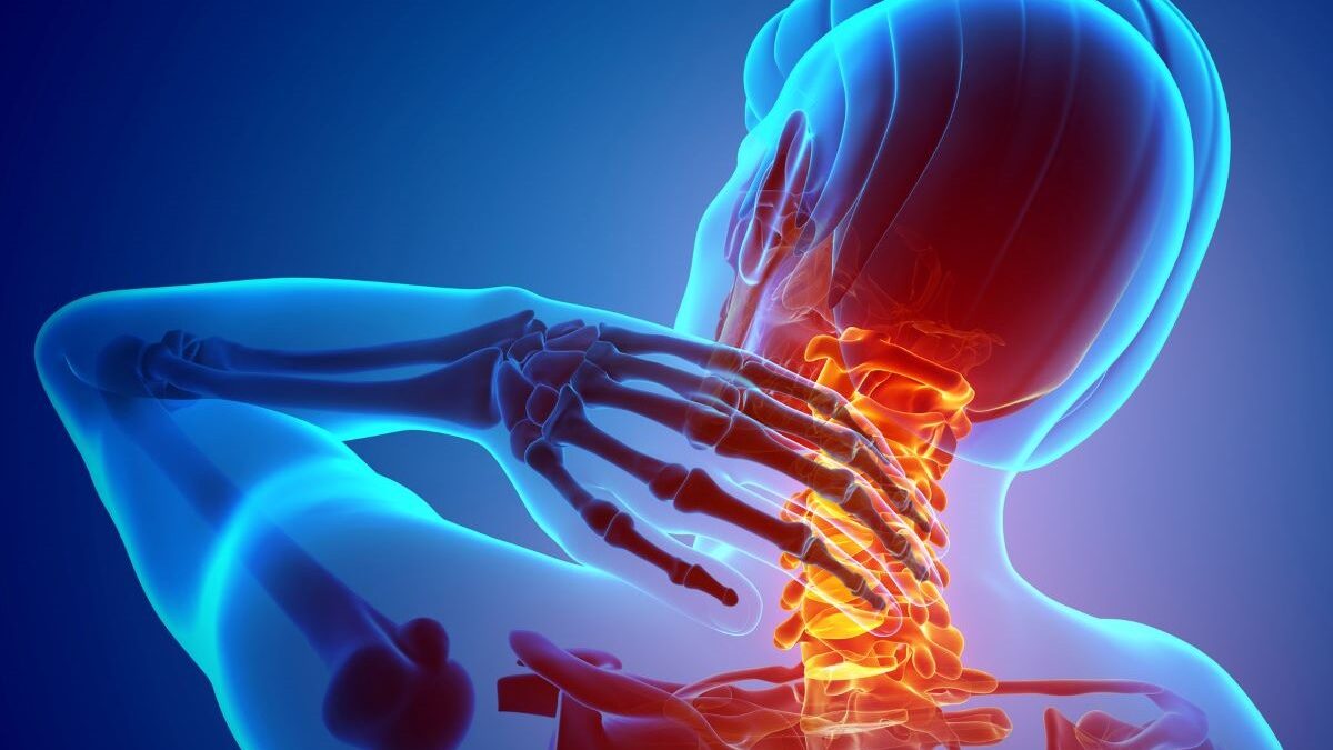Understanding Neck and Upper Limb Pain: Prevalence, Risk Factors, and Myths Understanding Neck and Upper Limb Pain: Prevalence, Risk Factors, and Myths