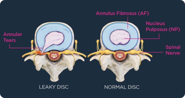 procedure-image