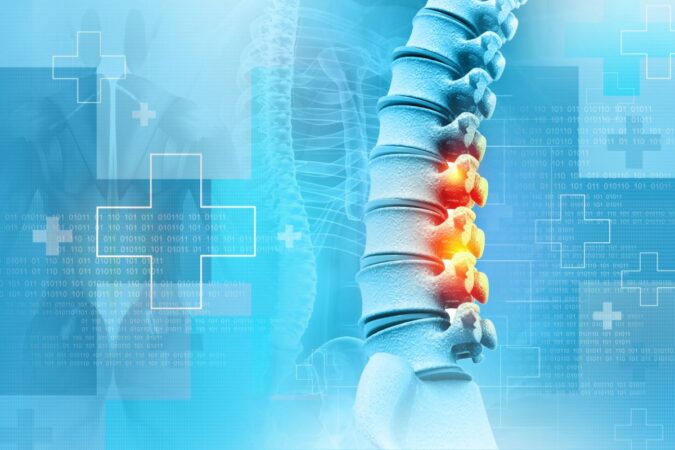 Finding Relief: Alternatives to Back Surgery Finding Relief: Alternatives to Back Surgery