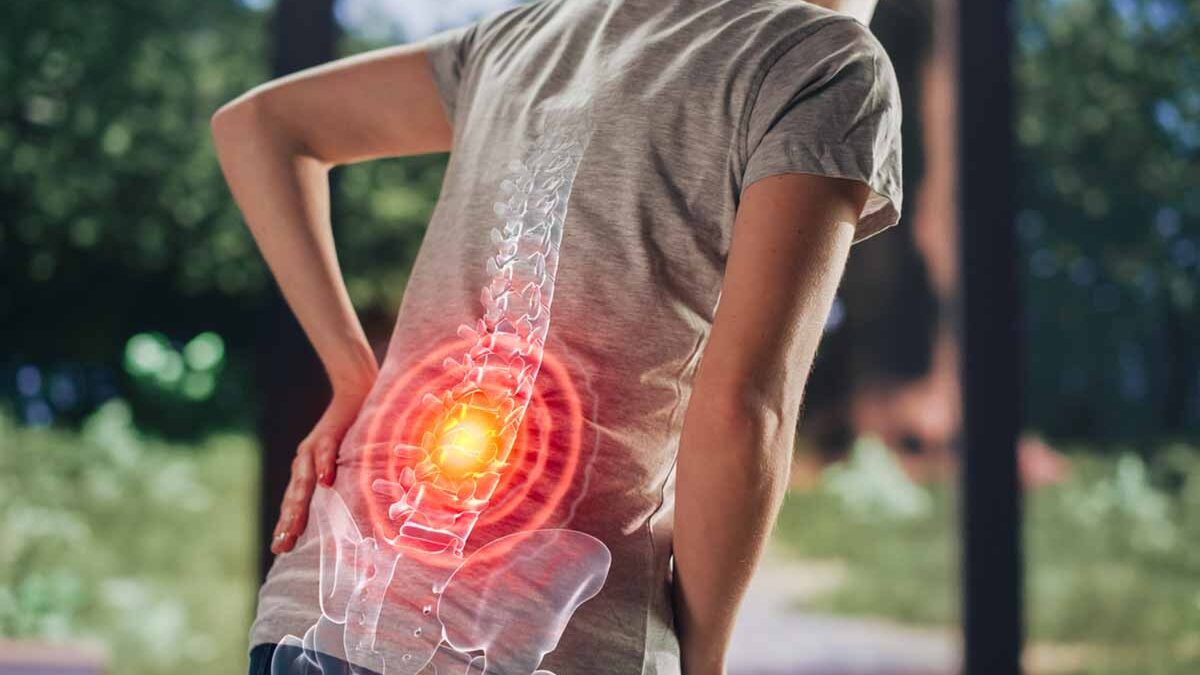 Facet Joint Syndrome & Facet Injections
