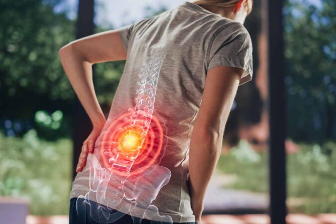 Facet Joint Syndrome & Facet Injections Facet Joint Syndrome & Facet Injections